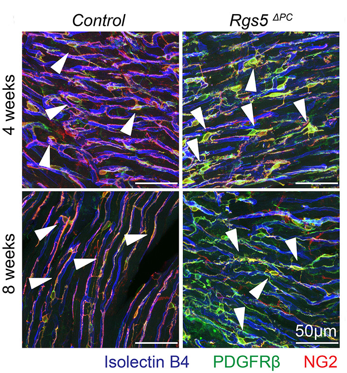 Tamiato et al found that #RGS5 is a crucial regulator of pericyte function, & its deletion causes cardiac dysfunction & induces myocardial #fibrosis in a #TGFβ dependent mechanism. Learn more at ahajrnls.org/4ak0MPF @AnitaTamiato @gluxan @WesleyAbplanalp