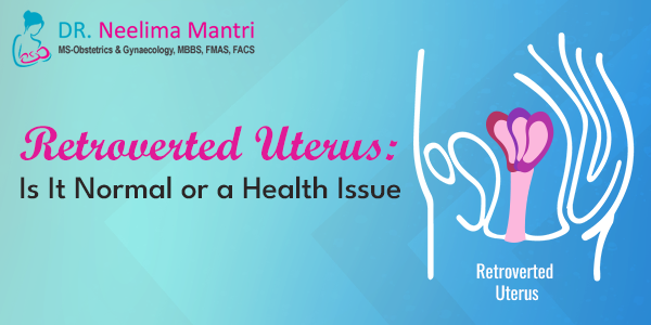 Retroverted Uterus: Is It Normal or a Health Issue The Retroverted uterus is a gynaecological condition where the uterus sits tilted towards the spine instead of its usual forward position.. Know more at: drneelimamantri.com/blog/retrovert… #RetrovertedUterus #Uterus #ReproductiveHealthCare