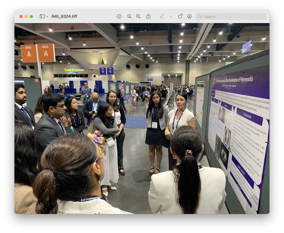 Poster area was busy & buzzy at 2024 ATS meeting today n San Diego today. Twas nice and old school: Researchers in front of their pinned posters, talking about study design & outcomes #2024ATS