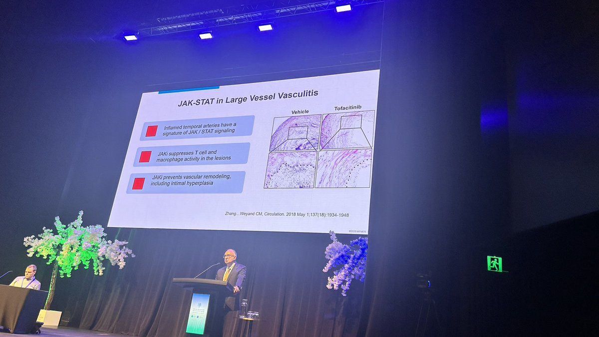 Bibimbap14's tweet image. Ken Warrington presents on GCA
⁃emerging treatments considering IL-6, IL-17, JAK-STAT targeted treatment
⁃Future treatment options…

#ARANZRA24 @MdWarrington @AusRheum