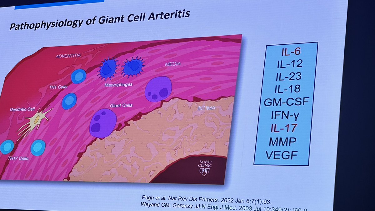 Bibimbap14's tweet image. Ken Warrington presents on GCA
⁃emerging treatments considering IL-6, IL-17, JAK-STAT targeted treatment
⁃Future treatment options…

#ARANZRA24 @MdWarrington @AusRheum
