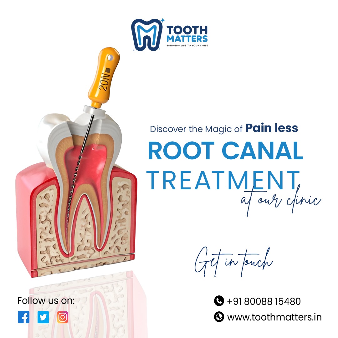 We at Tooth Matters are experts in painless root canal treatments by using advanced microscope and minimal access techniques. Consult us today.
#toothmatters #toothpain #rootcanaltreatment #microscopicdentistry #fillings #scaling #toothwhitening #pediatricdentistry #SmileMakeover