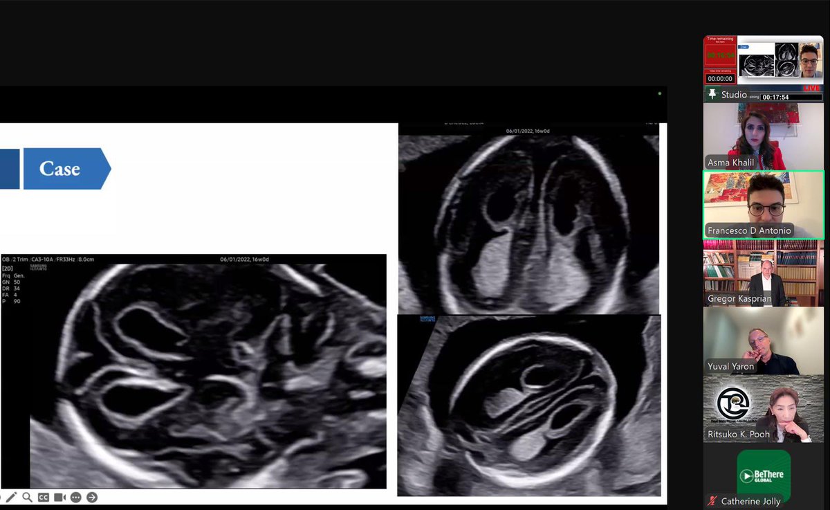 Glad how successful the @ISUOG course on ‘Exploring the fetal brain: imaging, prognosis and counselling’ today. Pleasure to organise it and huge thanks to the speakers, co-chairs and ISUOG staff, and most importantly, the large number of interactive delegates.