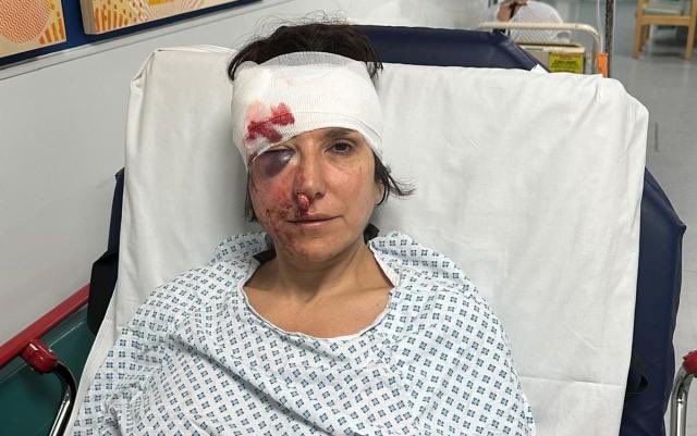 Last week a dog walker suffered severe facial injuries and was knocked unconscious after she was hit by a “speeding” cyclist overtaking a car at the same spot in Regents Park where a pensioner was struck and killed by a cyclist reaching speeds of 29mph in the 20mph zone in 2022.