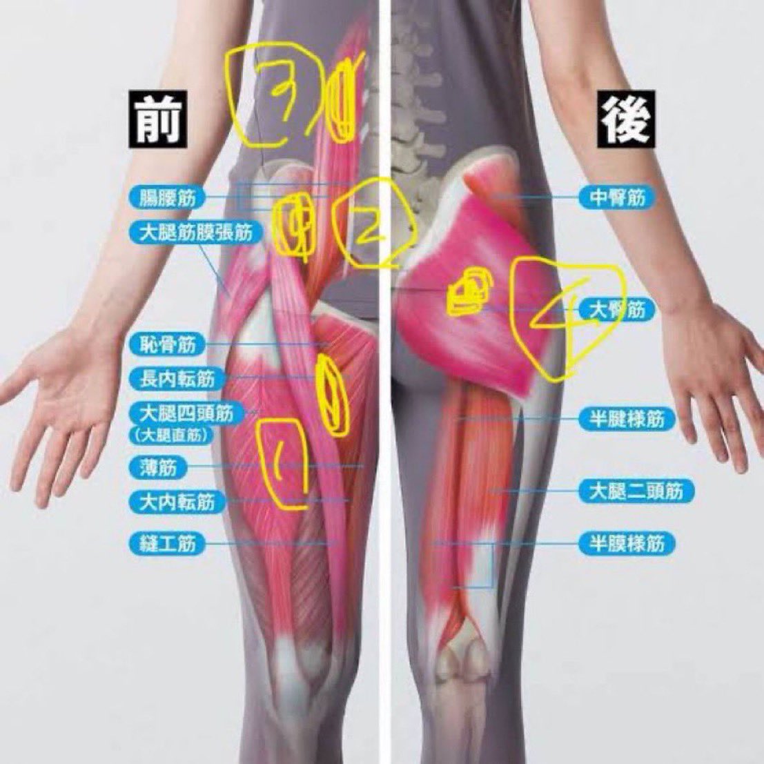 Japan_therapist's tweet photo. 開業当初....
本当にケツばっかり揉んでました。

坐骨神経痛と聞いて臀部の硬結を必死にリリースしてた開業したばかりの僕へ📨💨

坐骨神経痛は股関節前面を狙え！⚡️

・縫工筋内側のゴリゴリ
・ASIS内側のゴリゴリ
・お腹（臍脇の腹筋の硬さ等）
・臀部はPSISと坐骨の間が多い

臀部だけを執拗にマッサージしても根本的な治療にはならないよ😎