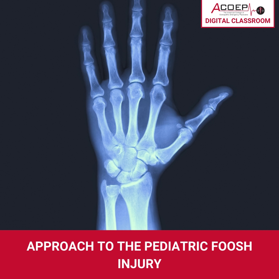 Unlock the secrets to addressing pediatric #FOOSH injuries like a pro! Gain invaluable insights into the approach to these common childhood injuries. Enroll now 📚 Learn More: tinyurl.com/4nxhu9hd