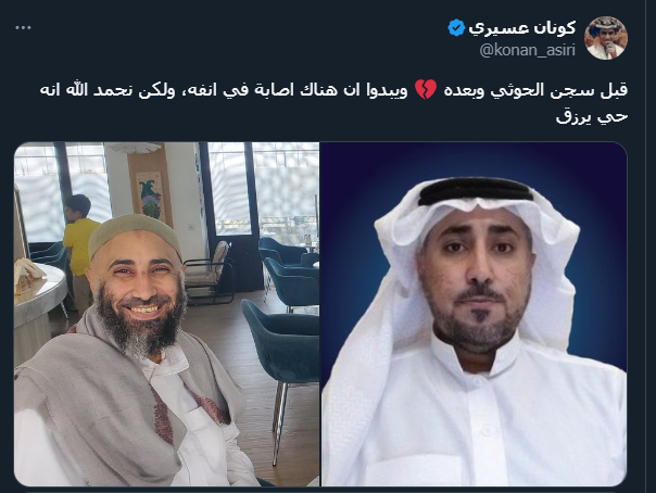 wlksaopp's tweet photo. قوم الخبيث سعد والتنكة الأشد خبثاً لا يزالون يمارون و يمترون بعد اخراج #ماجد_الأسمري على نفس سيناريو أسامة الحسني 
يريدون إعادة الأسمري للسجن او اخفائه او تسلميه للنظام بأي طريقة حتى لا يفضح ما يعرفه عنهم و حتى لا يفتح ملف تخليهم عنه
تغريداتهم تجرم الحوثي تأليباً كتوريط الحسني https://t.co/APHL1852Sb