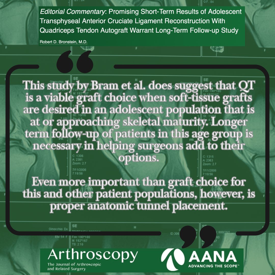 Editorial Commentary: Promising Short-Term Results of Adolescent Transphyseal Anterior Cruciate Ligament Reconstruction With Quadriceps Tendon Autograft Warrant Long-Term Follow-up Study #PediatricACL #ACLR ow.ly/tEms50Rt3mH