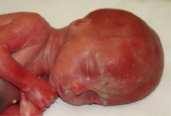Mom Screams for Clinic to Call 911 When Baby Born Alive After Abortion buff.ly/3pfvBmD