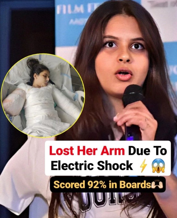 greater_jammu's tweet photo. IB Special - Almost two years ago, Mumbai girl Anamta Ahmed - then 13 years old - suffered a massive shock and extensive burn injuries after she touched an 11KV cable while playing with her cousins on a visit to Aligarh. 
.
.
#anamtaahmed #icse #icseboard #brave #greaterjammu https://t.co/Ns5LHOEGdh