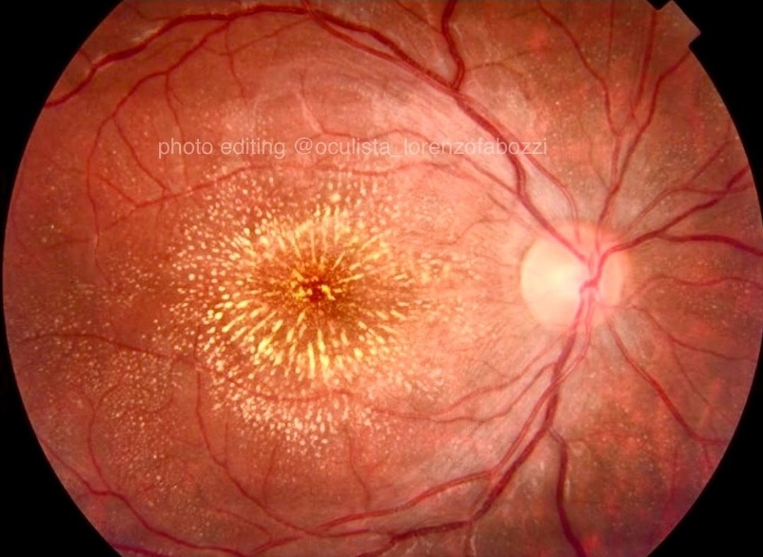 What is your diagnosis?
Hint: A cat just scratched the patient.
#MedTwitter #MedEd #medtr