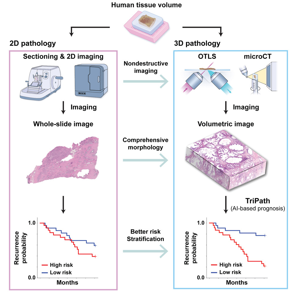 A very interesting application of #AI to analyze 3D #pathology samples.

'Patient prognostication based on 3D pathology yields superior performance to traditional 2D histopathology', thanks to TriPath, a 3D pathology #DeepLearning platform.

#Science 
⏯️cell.com/cell/fulltext/…