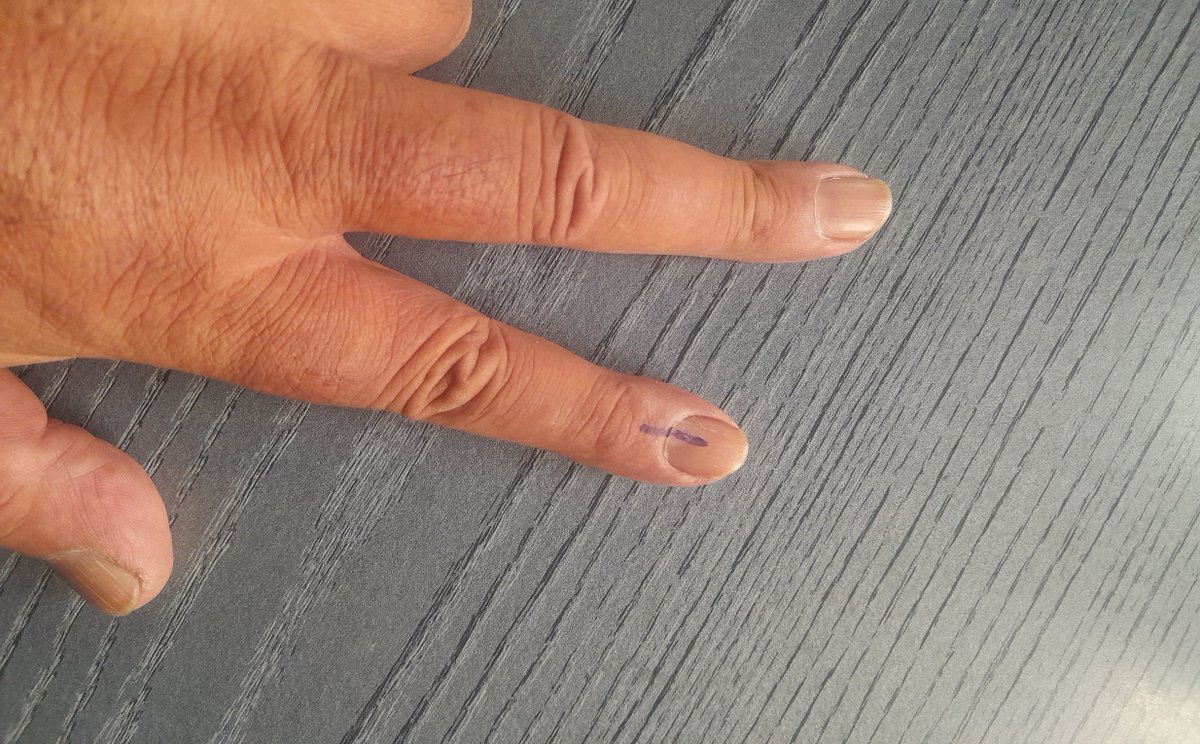 harishwings (@harishwings) on Twitter photo I CAST MY VOTE <a href="/ThePuneMirror/">Pune Mirror</a>
Did you?
REMEMBER:
"Elections belong to the people.
It's their decision.
If they decide to turn their back on the fire and burn their behinds, then they will just have to sit on their blisters."
~ Abraham Lincoln I CAST MY VOTE <a href="/ThePuneMirror/">Pune Mirror</a>
Did you?
REMEMBER:
"Elections belong to the people.
It's their decision.
If they decide to turn their back on the fire and burn their behinds, then they will just have to sit on their blisters."
~ Abraham Lincoln