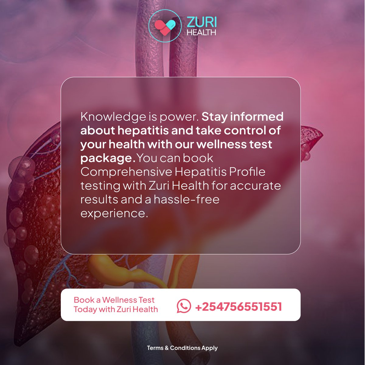 What do you need to know about viral hepatitis? 🤔 🤔

Find out from the carousel below

For bookings, contact us via WhatsApp on +254756551551 📲

#HealthAwareness #ZuriHealth #ChatWithADoctor #TelemedicineInKenya #HealthTech #Vera #AI #ZuriHealthServices
