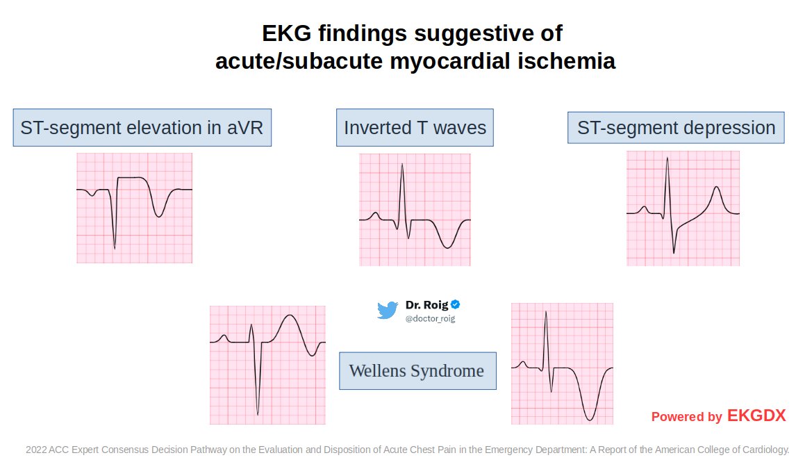 10/ The panel also listed EKG findings suggestive of acute or subacute myocardial ischemia. 

I will explain some of them.

@ekgdx #ekgdx