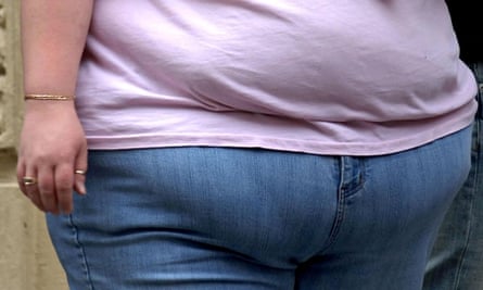 Obese & overweight people are much more likely to be off work through illness. Should the UK follow countries like Japan & South Korea by implementing a fat tax or surcharge on fattening food and beverages & fining companies employing too many fat people?