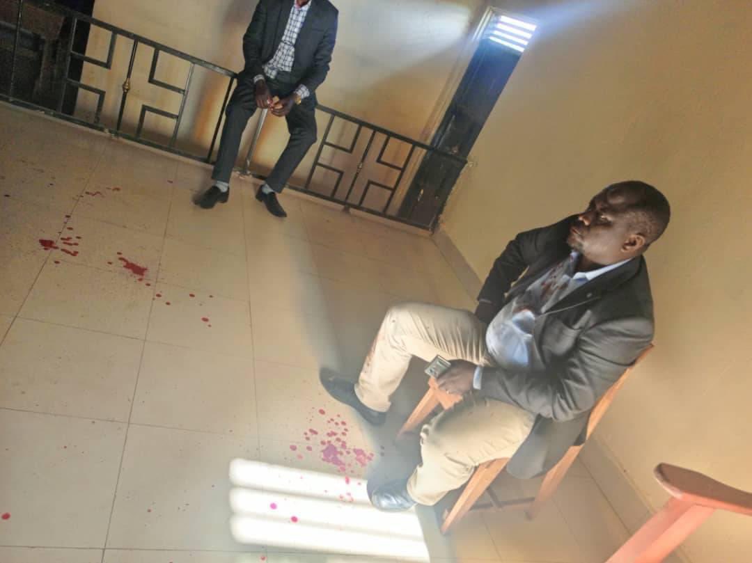 Christians from Rwanyamabare Catholic Church in Buhweju District were shocked after a group of goons attacked them after prayers and injured a number of individuals including the area MP Mwijukye Francis. It is said that the land where the church is located is being contested for…