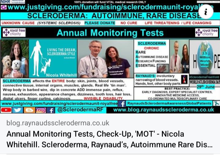 Annual Monitoring Tests: 
blog.raynaudsscleroderma.co.uk/2017/04/annual… 
This year, 2024, I will have spent over half of my life, 27 years, living with a scleroderma (systemic sclerosis) and Raynaud's diagnosis, and all that entails. 🤢
Read more:  royalfreecharity.org/news/fundraisi… 
#SclerodermaFreeWorld