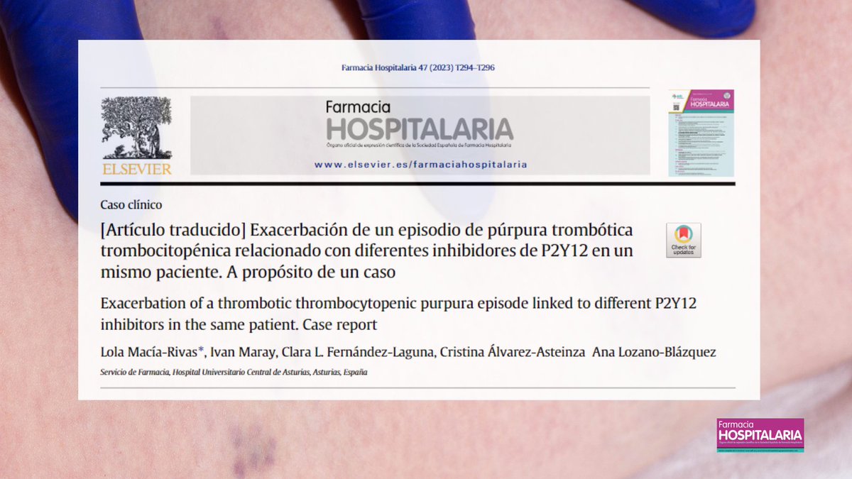 Exacerbación de un episodio de púrpura trombótica trombocitopénica relacionado con diferentes inhibidores de P2Y12 en un mismo paciente.  @FarmaciaHUCA @Lola_MR_ @ivanmaray @analozanob @cris_asteinza #RevistaFarmaciaHospitalaria #HospitalPharmacy revistafarmaciahospitalaria.es/es-articulo-tr…