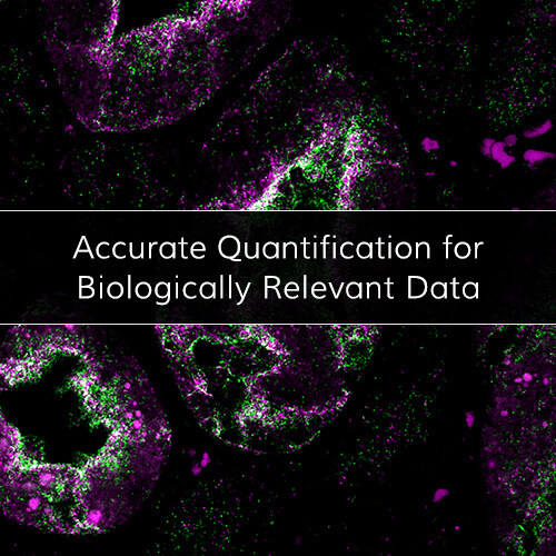 With MolBoolean™ our partner Atlas Antibodies unveils a revolutionary molecular tool: a groundbreaking in situ proximity technology designed to revolutionize protein analysis.
Learn more: hubs.li/Q02wVtQR0
#molboolean #proteinproteininteraction #molecularbiology
