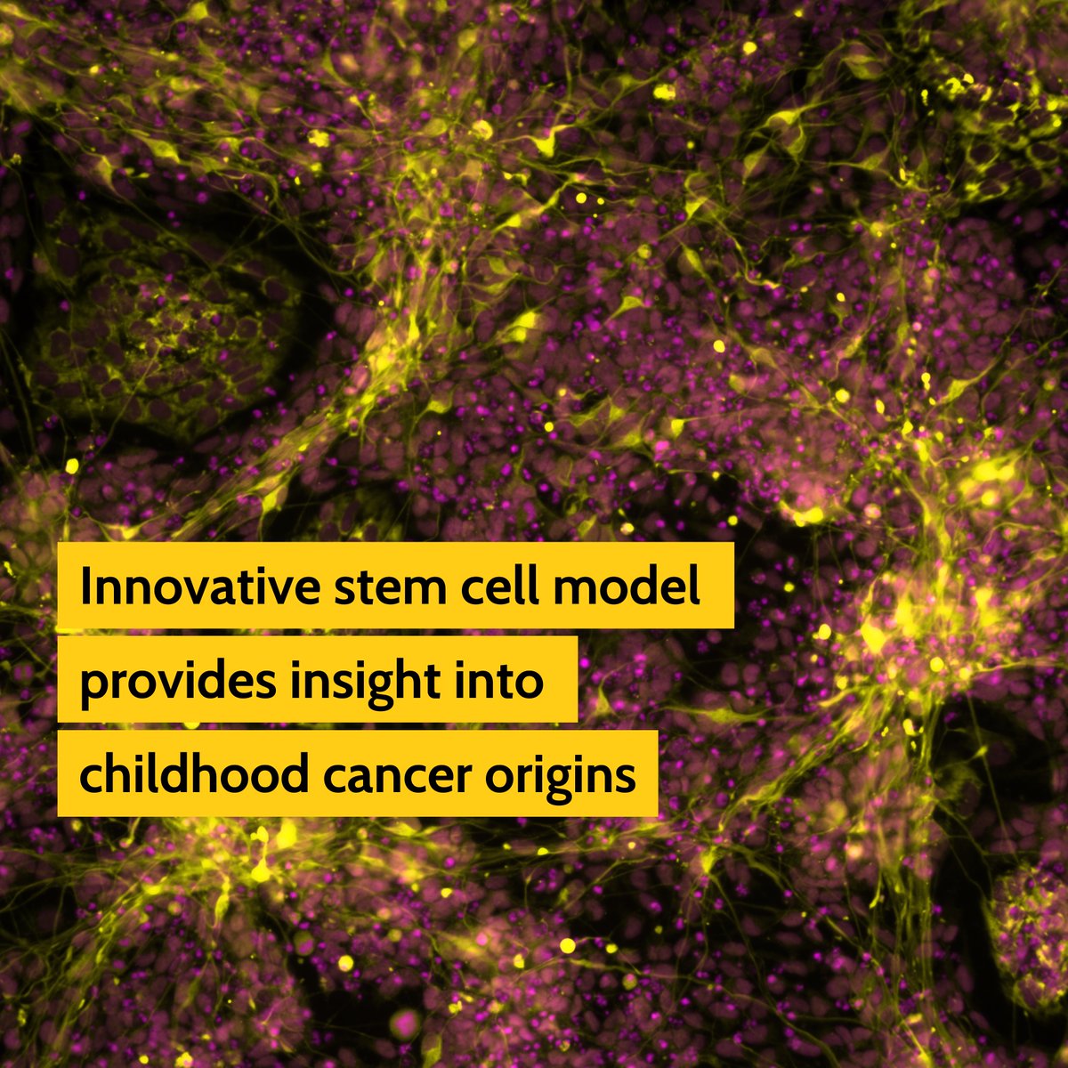 🧬 Groundbreaking research from @sheffielduni & @StAnna_CCRI unveils a new model illuminating the origins of neuroblastoma, a cancer impacting infants. Published in Nature Communications, it reveals key genetic pathways fueling this disease.📸© Dr. Ingrid Saldana