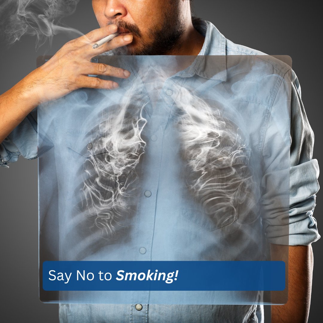 Looking to kick the habit for good? We're here to support you every step of the way with our Smoking Cessation Programme.
Contact us at milespharm@gmail.com to learn more or book your appointment.