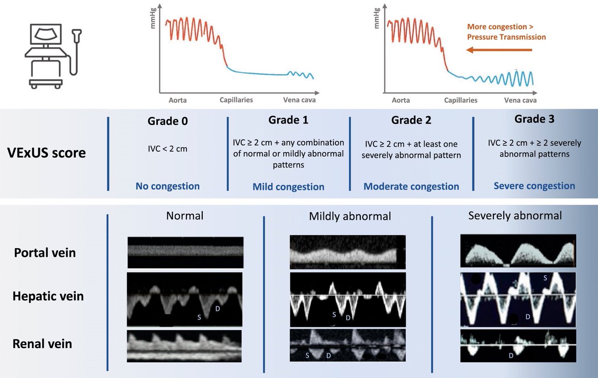 🆕 Imagen no invasiva en la insuficiencia cardiaca aguda con fracción de eyección preservada.

📕 Eur Heart J Acute Cardiovasc Care
📁 cardioteca.com/insuficiencia-…