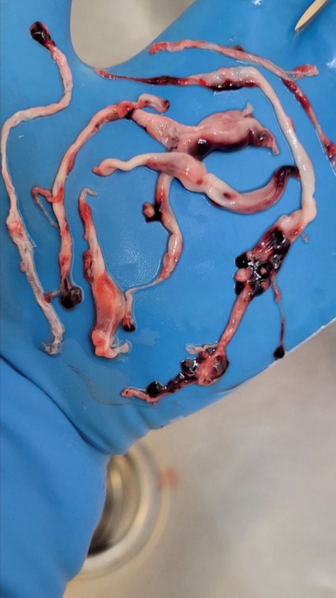 BGatesIsaPyscho's tweet photo. Dear Vaccinated,

Things you should probably be worried about:-

- Blood Clots
- Myocarditis
- Dying Suddenly
- Strokes
- Auto-immune deficiency 
- Turbo Cancer

Things you probably shouldn’t be worried about:-

- Covid 
- People not wearing masks 
- Long Covid
- Climate Change https://t.co/RfFvXYW8tE
