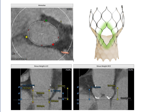 CCC Live Cases tweet media