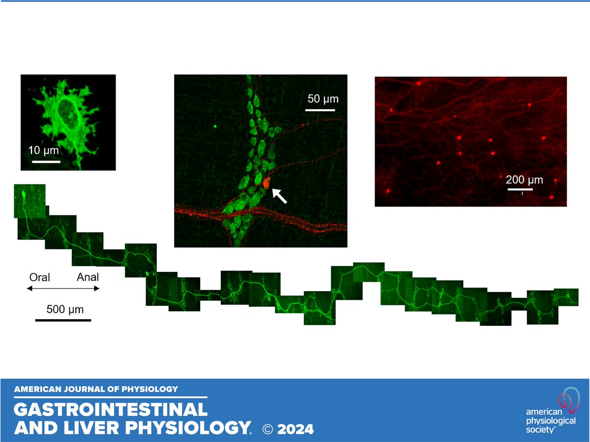 .@ajpgi Podcast ⚠️ Authors Jia Liu & Bin Feng highlight research titled 'Morphological, molecular, & functional characterization of mouse glutamatergic #MyentericNeurons' 🎧ow.ly/NNXZ50REthO 📃ow.ly/ZiGn50REtll #Glutamate #VesicularGlutamateTransporter #CalciumImaging