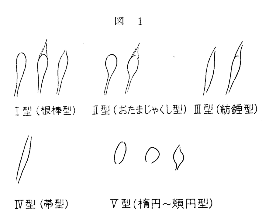 nobuuuuu525252's tweet photo. 精丘（前立腺初期化スイッチ）の形状を研究した論文です。
画像1枚目は、尿道に造影剤を注入して斜め前から撮影したX線画像。
膀胱に近い尿道にポッコリした膨らみが見えますね、これが精丘です。
人によって形が違います。
ここをグリュグリュするとメスイキします。
https://t.co/IojDfLLTPG https://t.co/FWT7njP90K