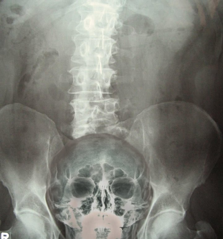 X- Ray of Chris Mason after asking his patsy question to Rishi Sunak #bbcnews