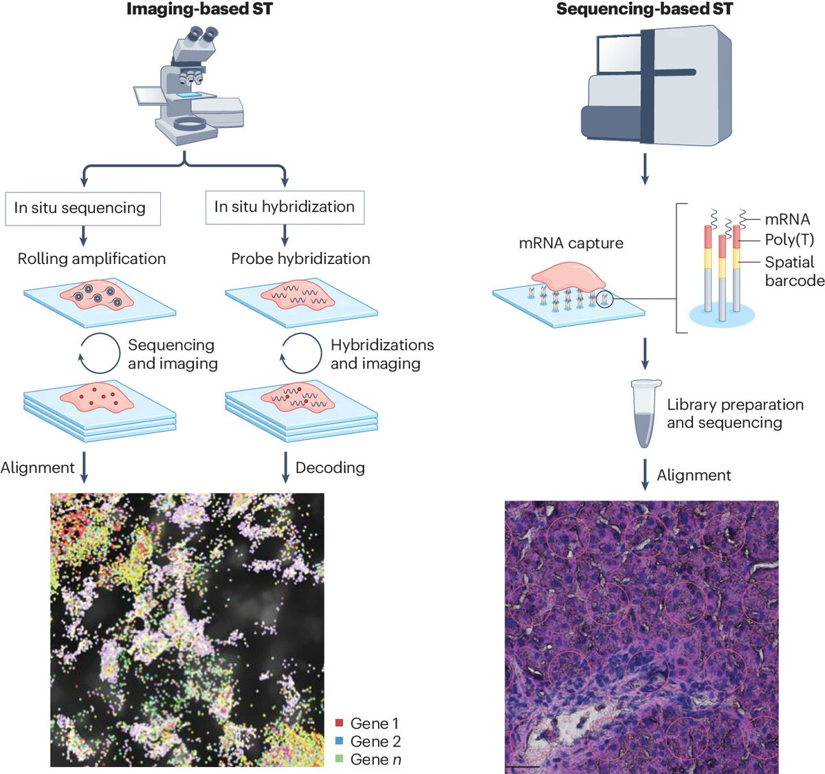 This REVIEW discusses knowledge of #MASLD development and progression and how the burgeoning field of #spatialgenomics is driving exciting new developments in our understanding of human liver disease pathogenesis and therapeutic target identification nature.com/articles/s4157…