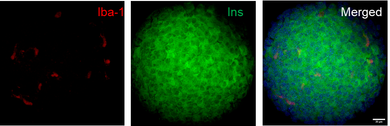 📢We are incredibly grateful to receive funding from @JDRF to explore if modulating islet-resident immune cells can delay or prevent #type1diabetes. 

Excited to continue collaborating with @JAPearsonLab @cardiffuni.

 Thank you @jdrf @JDRFUK! 

@kingscardio @KHPDEO @DRG_Kings.