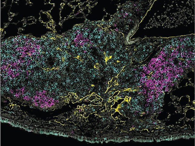 #Endothelium bearing the #mutation initiates the #lung pathology in patients with mutated STING gene –potential treatment target. Image & research by @ImmunoKevin et al @FitzgeraldKate & Ann Rothstein labs @UMassChan in @CellReports. Link & vast archive on bpod.org.uk/archive/2024/5…