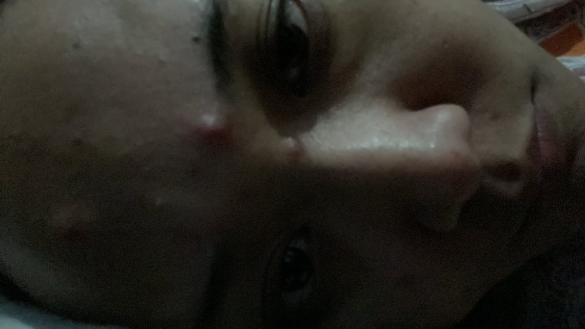 Lagi jelek bgt ini muka :(