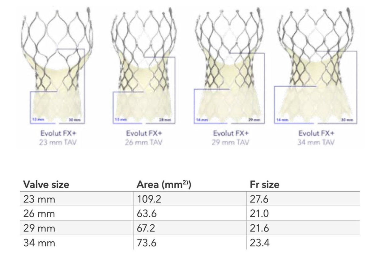 Congrats <a href="/StFrancis_LI/">St. Francis Hospital & Heart Center</a> <a href="/UPMC/">UPMC</a> #Pinnacle teams on performing 1st Evolut FX+ #TAVR in the 🌎with easy coronary access with commissural alignment. Game changer on this valve. <a href="/CathElectroSurg/">Jaffar Khan</a> #HemalGada <a href="/MDT_StructHeart/">Medtronic Structural Heart</a>