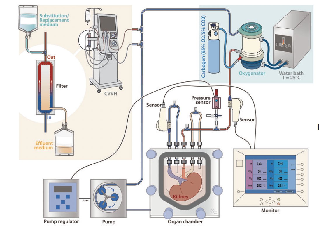 Using spatial metabolic flux we identified the conditions  to preserve discarded human donor kidney’s for at least 4 days ex vivo. Such an approach also holds the potential for resuscitation and could increase the window for organ allocation. rdcu.be/dHL6W
