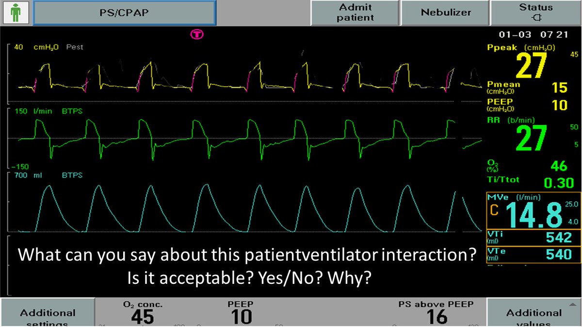 @DocMusician @DrMiguelIbarra1 @emireles_c @CCF_PCCM @MegriMohammed @_MSAMEED @IM_Crit_ @critconcepts @RespiratorySCCM @SaudiRTs @OfVentilation