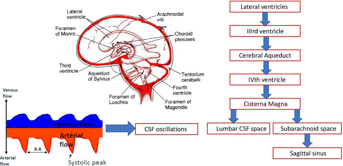 Today's Paper of the Day is on hydrocephalus and the neuro-intensivist: CSF hydrodynamics at the bedside criticalcarereviews.com/latest-evidenc… Join us to read 1 paper per day and stay up-to-date as we cover the spectrum of critical care across 2024