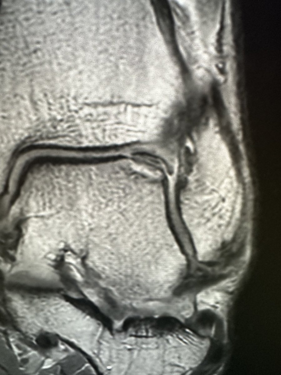 Example of how good quality radiographs can still provide high-quality information