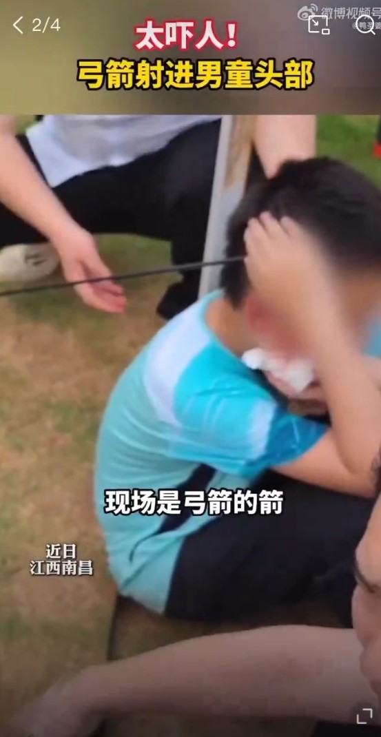 While out #bowhunting #DogsAndCats , 🇨🇳Chinese hunters shot an arrow in a #Chinese boys HEAD.
#Bowhunting #DogsAndCats is what #CCP🇨🇳 encourages instead of #spayneuter and #shelters.

#CatsOfTwitter #SaveTheChildren #PuppyOfTheDay #BeltAndRoad #Cobalt 
#BoycottChina 🇨🇳
