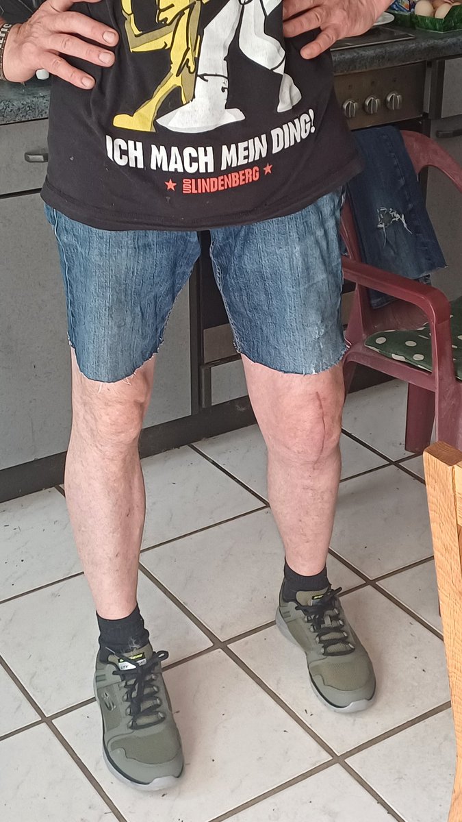 Ist das so ein Vater ding, das wenn die Hose ein Loch hat, sie kurz geschnitten wird???