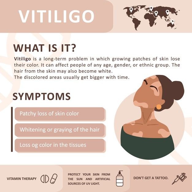 For those who aren't aware of Vitiligo here is some awareness on it. As one who has been diagnosed it has taught me you can look different to anyone and everyone but never compare yourself we are all blessed differently #CPUTMediaCreatives
#CPUTMedia #Selflove