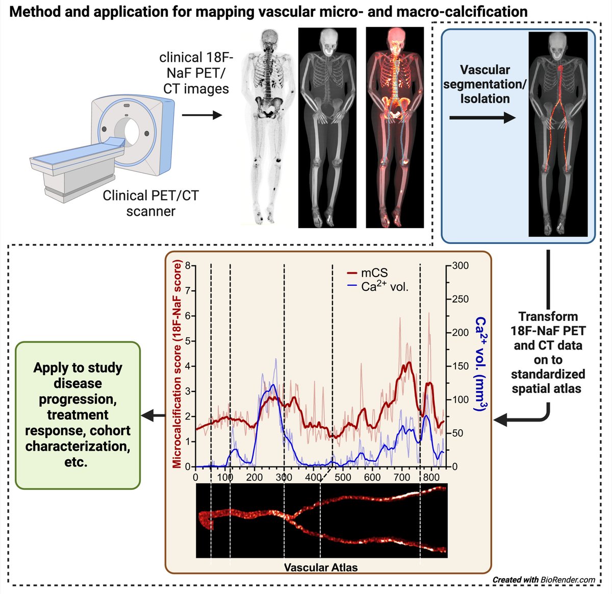 Vascular micro- and macro- calcification from 18F-NaF PET/CT can be mapped onto a spatial atlas, serving as a novel technique to sensitively detect and track vascular calcification across space a... @A_sheppard9 @babaksaboury @Faraz_Farhadi @elizabeththeng ahajrnls.org/3UYvQ2P