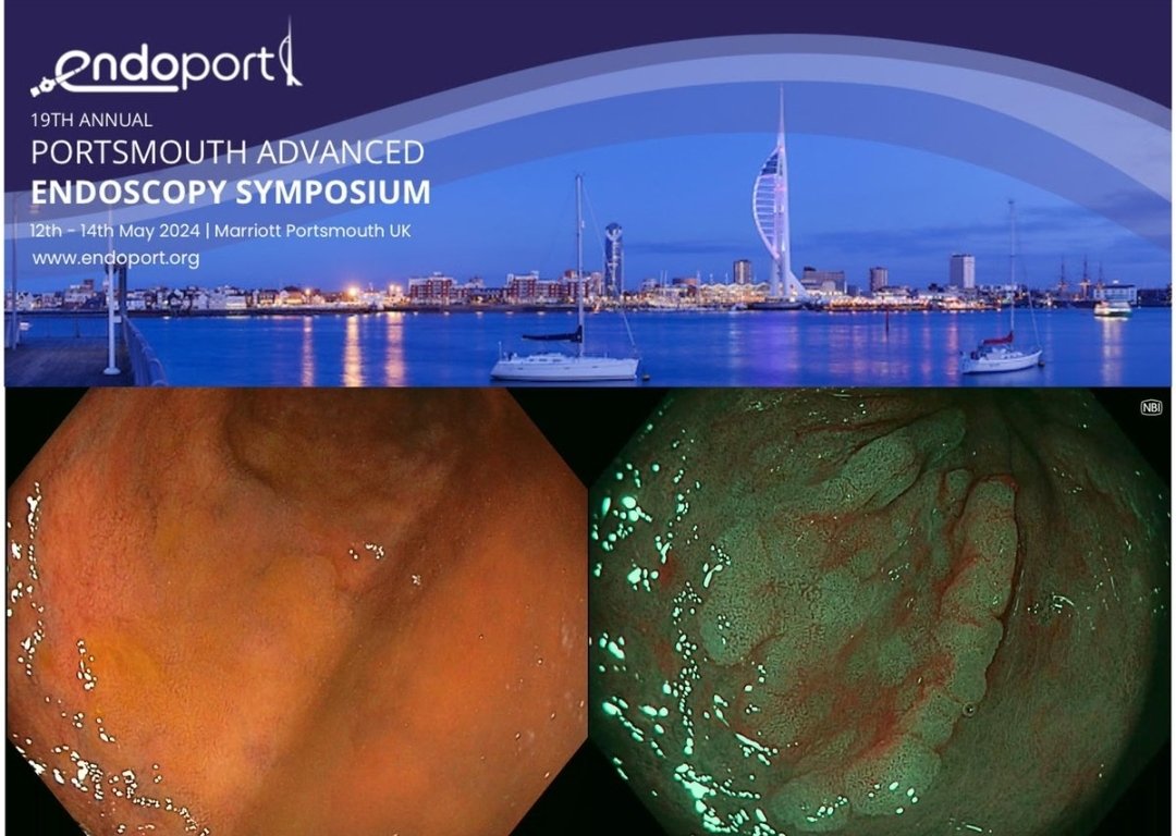 And that's a wrap for live cases for <a href="/endo_port/">Endo_Port</a> <a href="/PHU_NHS/">Portsmouth Hospitals University NHST</a>. A privilege to work with our expert faculty, providing brilliant patient care and experience. I'm super proud of our Endo team at its best! <a href="/gastro3570/">Pradeep Bhandari</a> <a href="/Hein_Gastro/">Hein M. T Htet</a> <a href="/SigKat3/">Katie Siggens</a> <a href="/TheRealFergusTP/">Fergus</a> <a href="/CathyLakePHT/">Cathy Lake</a> <a href="/ginastanley73/">Gina Stanley</a>