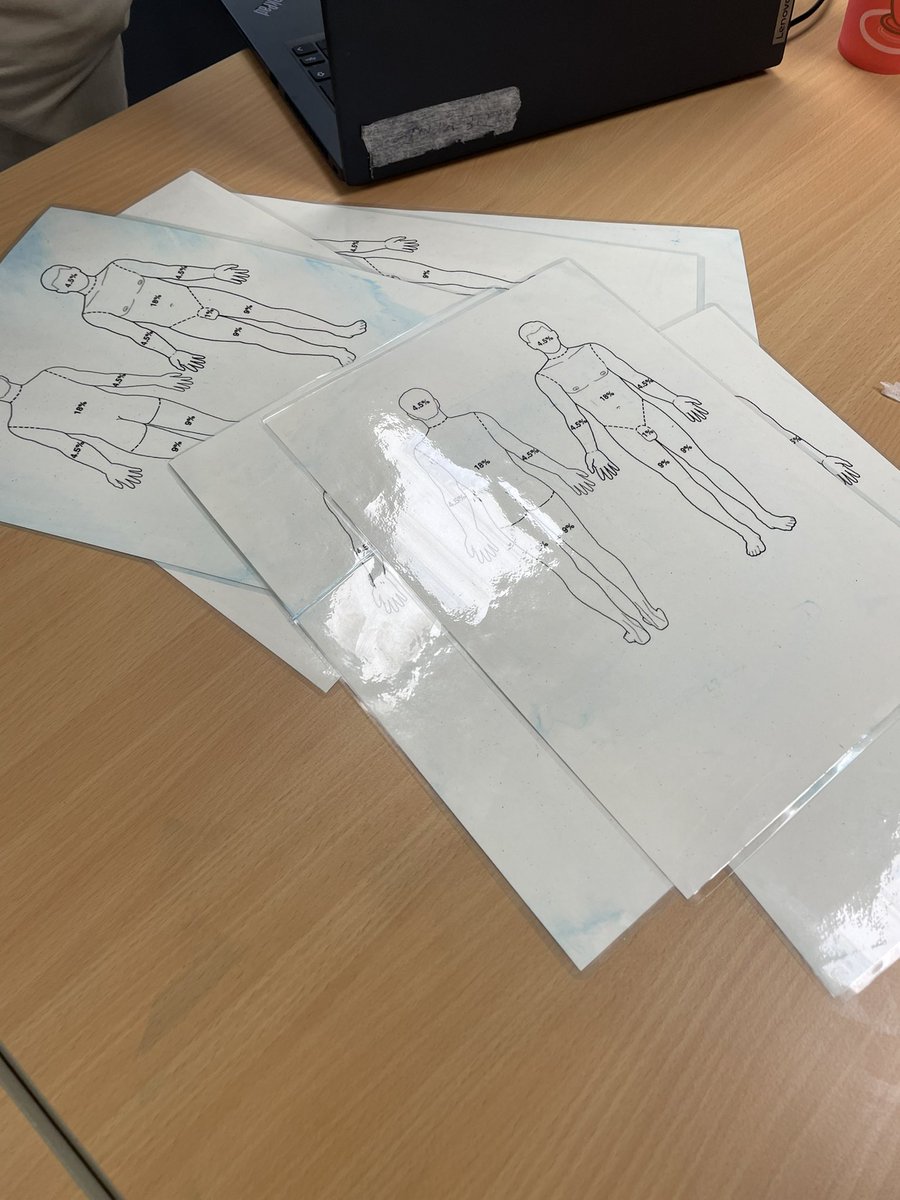 stephstewart_15's tweet photo. What a day! Brilliant #burnssim day @burnsunitBHT. From Burns Emergency Management to having a go at performing an escharotomy & completing a brochoscopy for a inhalation burn. Science is amazing 🩺👩🏼⚕️❤️🩹 #burnsunit #mdt #burnsphysio https://t.co/VJpBEwr5Wp
