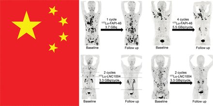 Advancing Global Nuclear Medicine: The Role and Contributions of China. ow.ly/63nT50REnMW #NuclearMedicine #China #MolecularImaging @ProfKHermmann @WeiboCai