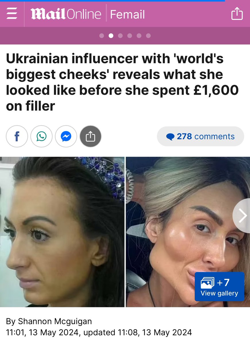Interesting, freaky looking cosmetic job that had to be a joke isn’t actually. Russian Influencer, 36 once looked normal , maybe something to do with the “War” I’m thinking dailymail.co.uk/femail/article…