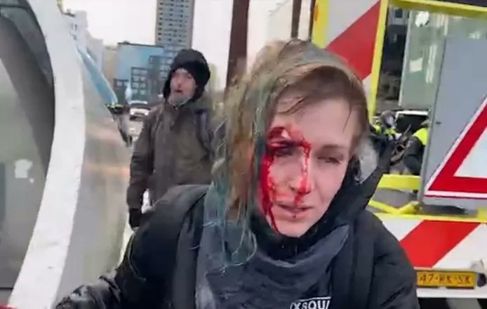 P0eMPieDinges's tweet photo. Vergeet niet!

De mensen die hoog van de toren blazen over 'politiegeweld' zijn dezelfde mensen die juichten toen een vrouw met een waterkanon een schedelbreuk met 18 hechtingen werd gespoten in Eindhoven.

Het zijn dezelfde mensen die riepen 'eigen schuld' Toen op het Malieveld een politiehond op een weerloze demonstrant (die al op de grond lag) werd gezet. Het gegil van de man ging door merg en been.

En ook zijn het de mensen die het vooral 'jammer' vonden dat een agent miste toen hij gericht had geschoten op de 16 jarige boer Jouke want zo had hij 'gewoon thuis moeten zijn'.

Werkelijk, ik ben deze hypocrisie KOTSBEU!
Gatverdamme, het is om te spugen.
Vies, smerig rotvolk!